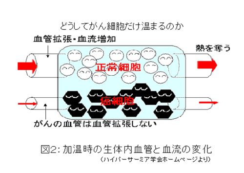 どうしてがん細胞だけ温まるのか