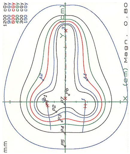 図4-2