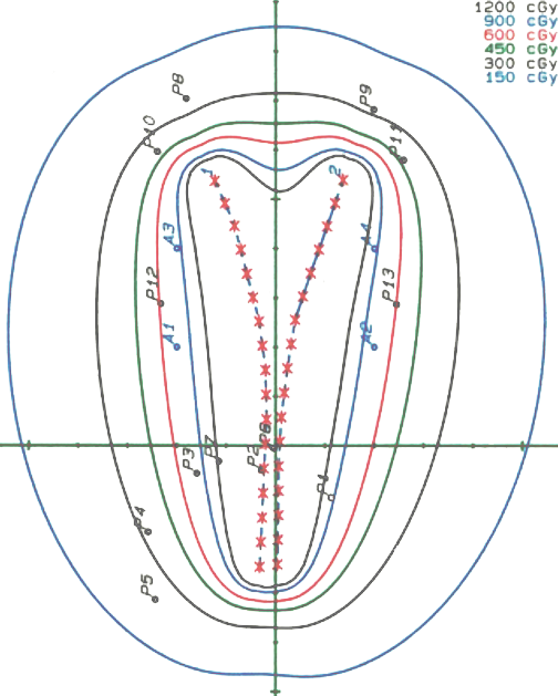 図3 腔内照射の線量分布図