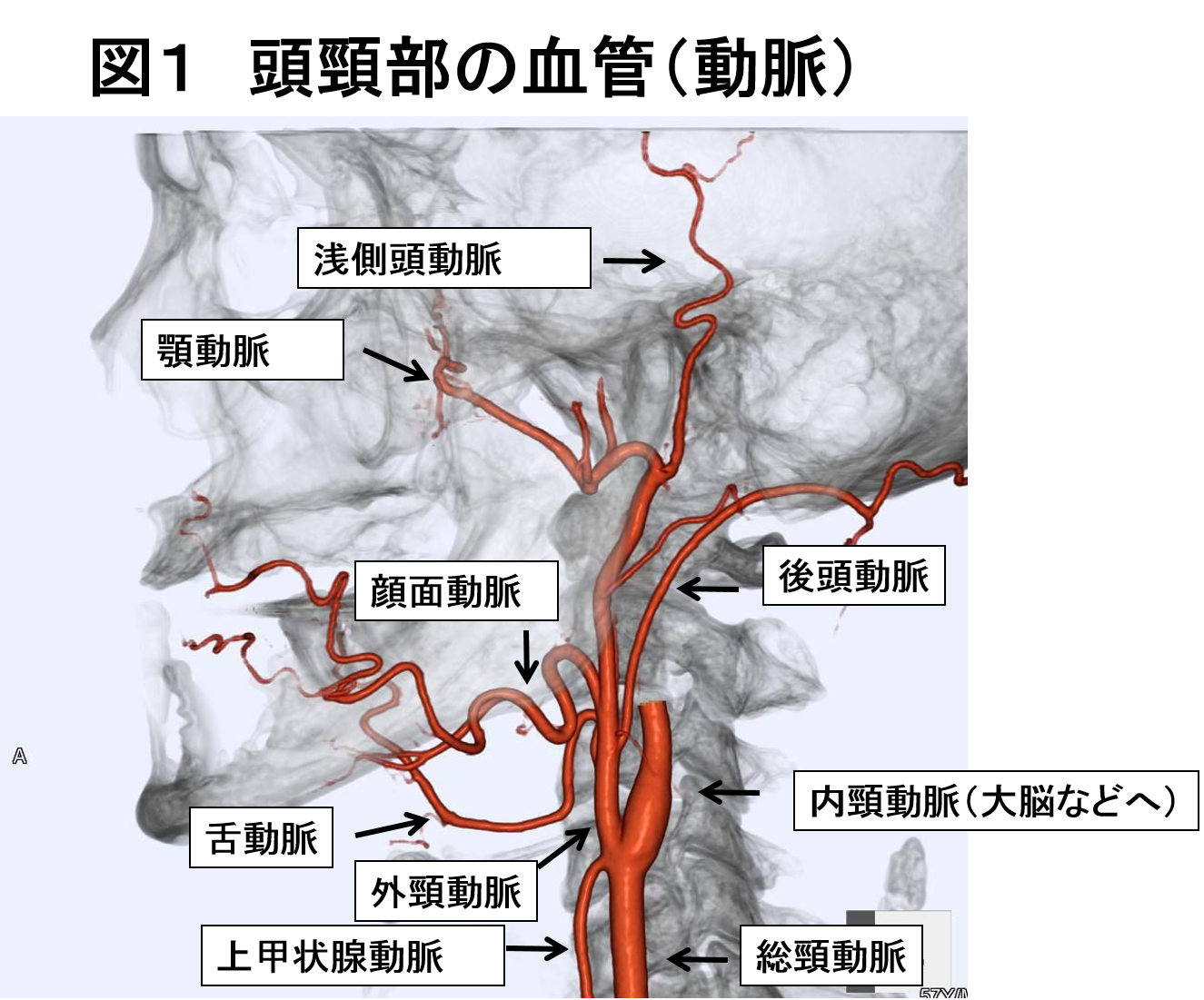 図1 頭頸部の血管(動脈)