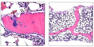 図3：正常骨髄組織像（Foucar K et al. Diagnostic Pathology Blood and Bone Marrow, Second Ed. (2014) Amirsys, Inc. から引用）