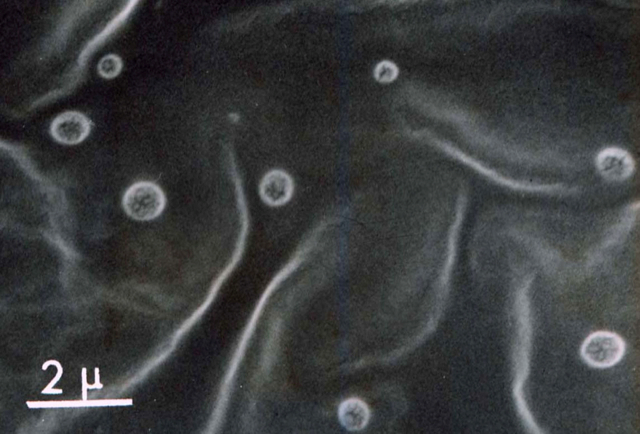 図2. 副流煙の電子顕微鏡写真