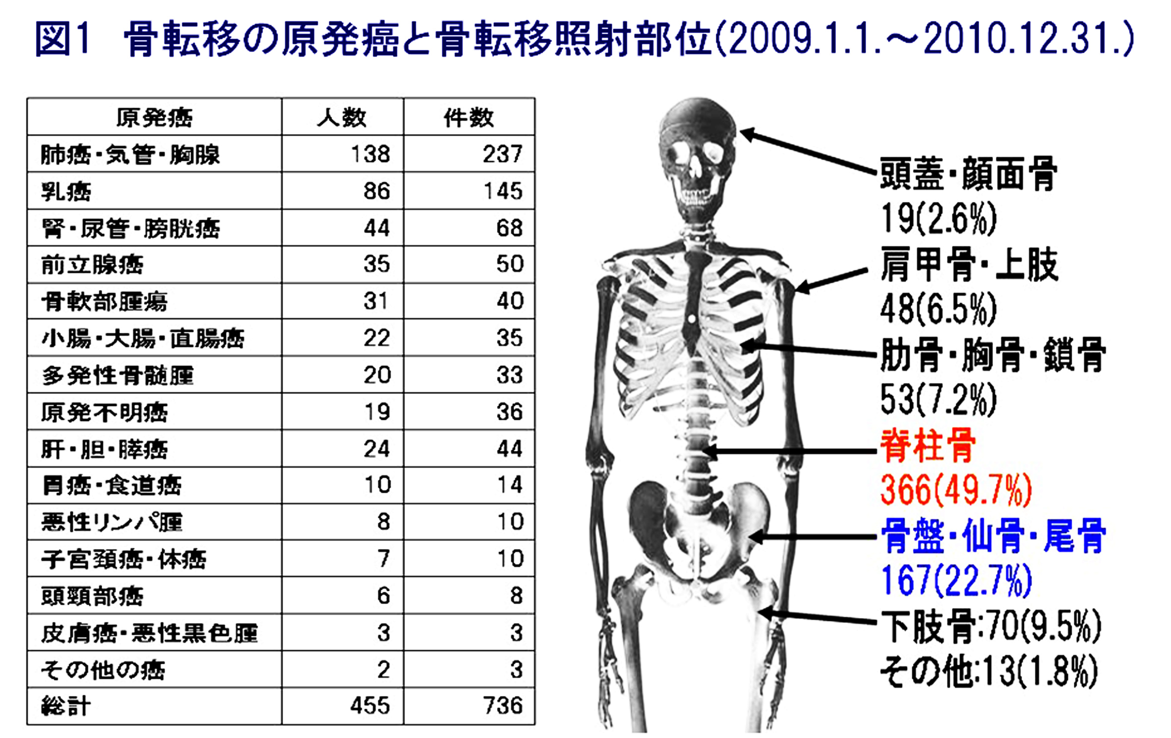 骨 転移 の 1ctp の 数値